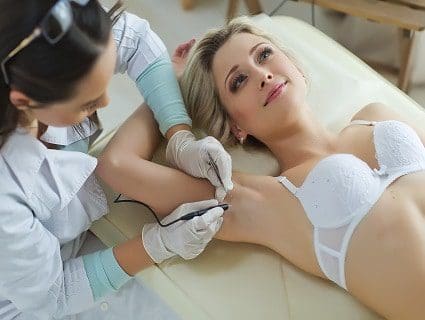 underarm-electrolysis